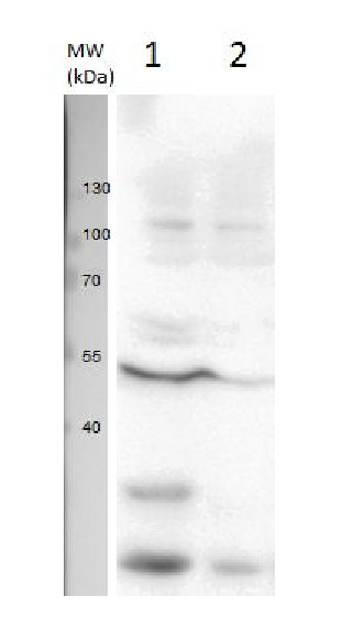 western blot using anti-U1 snRNP protein A | U1 small nuclear ribonucleoprotein A antibodies